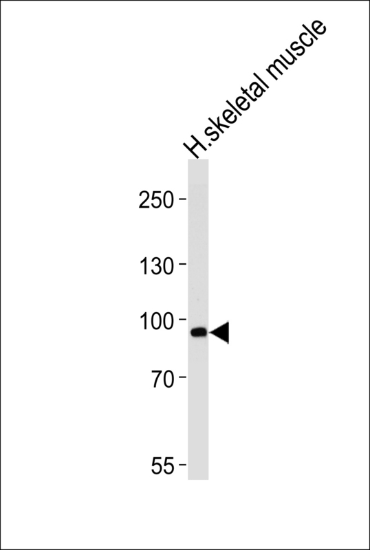 PFKM / PFK-1 Antibody - Western blot of lysate from human skeletal muscle tissue lysate, using PFKM Antibody. Antibody was diluted at 1:1000 at each lane. A goat anti-rabbit IgG H&L (HRP) at 1:5000 dilution was used as the secondary antibody. Lysate at 35ug per lane.