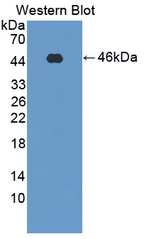 PFKM / PFK-1 Antibody - Western blot of PFKM / PFK-1 antibody.