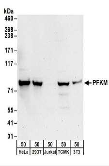 PFKM / PFK-1 Antibody - Detection of Human and Mouse PFKM by Western Blot. Samples: Whole cell lysate (50 ug) from HeLa, 293T, Jurkat, mouse TCMK-1, and mouse NIH3T3 cells. Antibodies: Affinity purified rabbit anti-PFKM antibody used for WB at 0.1 ug/ml. Detection: Chemiluminescence with an exposure time of 30 seconds.
