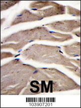 PFKM / PFK-1 Antibody - Formalin-fixed and paraffin-embedded human skeletal muscle reacted with PFKM Antibody , which was peroxidase-conjugated to the secondary antibody, followed by DAB staining. This data demonstrates the use of this antibody for immunohistochemistry; clinical relevance has not been evaluated.