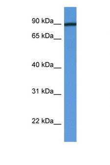 PFKM / PFK-1 Antibody - PFKM / PFK-1 antibody Western blot of Fetal Heart lysate. Antibody concentration 1 ug/ml.  This image was taken for the unconjugated form of this product. Other forms have not been tested.