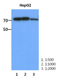 PFKM / PFK-1 Antibody - Western Blot: The HepG2 cell lysate (30 ug) were resolved by SDS-PAGE, transferred to PVDF membrane and probed with anti-human PFKM antibody (1:500-1:2000). Proteins were visualized using a goat anti-mouse secondary antibody conjugated to HRP and an ECL detection system.