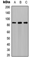 PFKM / PFK-1 Antibody - Western blot analysis of PFKM expression in SHSY5Y (A); A549 (B); Ramos (C) whole cell lysates.