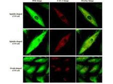 PFKM / PFK-1 Antibody - #Confocal microscopy images using the anti-F6PK MAGP-2 antibody shows specific staining.  Cultures of A7r5 VSM cells (rat aorta) were labeled with anti-F6PK (PFK) at 1:200 and anti-caveolin (CAV)-1.  Images from labeled A7r5 cells were acquired separately for PFK fluorescence (green) and CAV-1 fluorescence (red) from each cell.