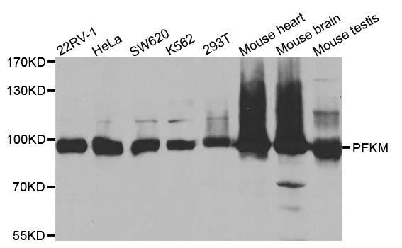 PFKM / PFK-1 Antibody - Western blot analysis of extracts of various cell lines.