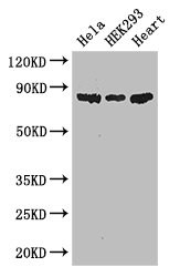 PFKM / PFK-1 Antibody - Positive WB detected in:Hela whole cell lysate,HEK293 whole cell lysate,Mouse heart tissue;All lanes: PFKM antibody at 3.4ug/ml;Secondary;Goat polyclonal to rabbit IgG at 1/50000 dilution;Predicted band size: 86 kDa;Observed band size: 86 kDa;