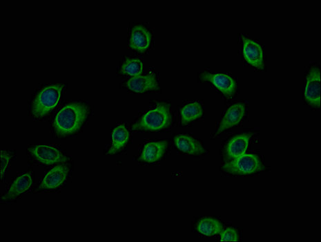 PFKM / PFK-1 Antibody - Immunofluorescent analysis of A549 cells using CSB-PA017823LA01HU at a dilution of 1:100 and Alexa Fluor 488-congugated AffiniPure Goat Anti-Rabbit IgG(H+L)
