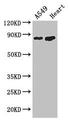 PFKM / PFK-1 Antibody - Western Blot Positive WB detected in: A549 whole cell lysate, Mouse heart tissue All lanes: PFKM antibody at 3.4µg/ml Secondary Goat polyclonal to rabbit IgG at 1/50000 dilution Predicted band size: 86, 82, 94 kDa Observed band size: 86 kDa