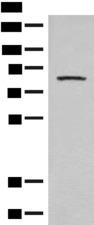 PFKM / PFK-1 Antibody - Western blot analysis of Mouse brain tissue lysate  using PFKM Polyclonal Antibody at dilution of 1:350