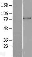 PFKM / PFK-1 Protein - Western validation with an anti-DDK antibody * L: Control HEK293 lysate R: Over-expression lysate