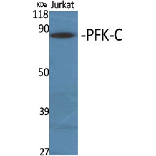 PFKP Antibody - Western blot of PFK-C antibody
