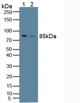 PFKP Antibody - Western Blot; Sample: Lane1: Human A549 Cells; Lane2: Human Jurkat Cells.