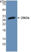 PFKP Antibody - Western Blot; Sample: Recombinant PFKP, Mouse.