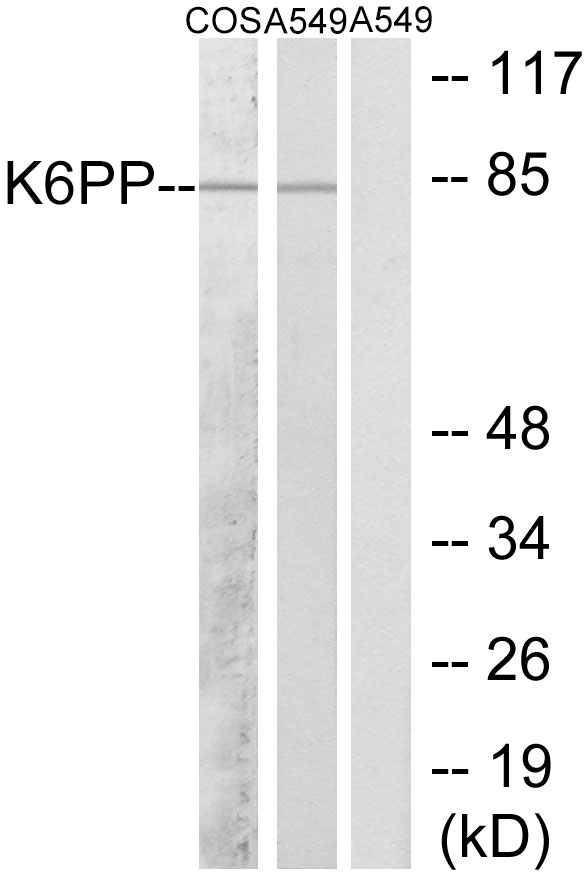 PFKP Antibody - Western blot analysis of lysates from A549 and COS7 cells, using K6PP Antibody. The lane on the right is blocked with the synthesized peptide.