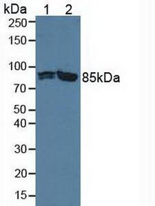PFKP Antibody - Western Blot; Sample: Lane1: Human Hela Cells; Lane2: Human Jurkat Cells.