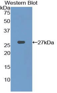 PFKP Antibody - Western blot of recombinant PFKP.