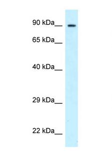 PFKP Antibody - PFKP antibody Western blot of 8226 Cell lysate. Antibody concentration 1 ug/ml.  This image was taken for the unconjugated form of this product. Other forms have not been tested.