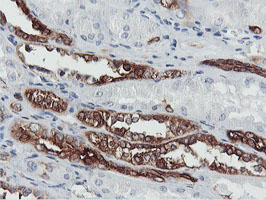 PFKP Antibody - IHC of paraffin-embedded Human Kidney tissue using anti-PFKP mouse monoclonal antibody.