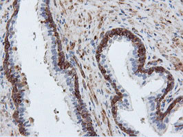 PFKP Antibody - IHC of paraffin-embedded Human prostate tissue using anti-PFKP mouse monoclonal antibody.