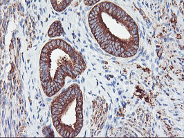 PFKP Antibody - IHC of paraffin-embedded Human endometrium tissue using anti-PFKP mouse monoclonal antibody.
