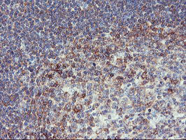 PFKP Antibody - IHC of paraffin-embedded Human tonsil using anti-PFKP mouse monoclonal antibody.