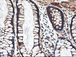 PFKP Antibody - IHC of paraffin-embedded Human colon tissue using anti-PFKP mouse monoclonal antibody. (Heat-induced epitope retrieval by 10mM citric buffer, pH6.0, 100C for 10min).