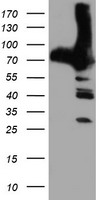 PFKP Antibody - HEK293T cells were transfected with the pCMV6-ENTRY control (Left lane) or pCMV6-ENTRY PFKP (Right lane) cDNA for 48 hrs and lysed. Equivalent amounts of cell lysates (5 ug per lane) were separated by SDS-PAGE and immunoblotted with anti-PFKP.