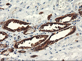 PFKP Antibody - IHC of paraffin-embedded Human Kidney tissue using anti-PFKP mouse monoclonal antibody. (Heat-induced epitope retrieval by 10mM citric buffer, pH6.0, 100C for 10min).