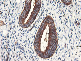 PFKP Antibody - IHC of paraffin-embedded Human endometrium tissue using anti-PFKP mouse monoclonal antibody. (Heat-induced epitope retrieval by 10mM citric buffer, pH6.0, 100C for 10min).
