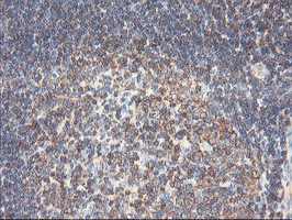 PFKP Antibody - IHC of paraffin-embedded Human tonsil using anti-PFKP mouse monoclonal antibody. (Heat-induced epitope retrieval by 10mM citric buffer, pH6.0, 100C for 10min).