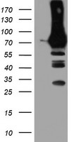 PFKP Antibody - HEK293T cells were transfected with the pCMV6-ENTRY control (Left lane) or pCMV6-ENTRY PFKP (Right lane) cDNA for 48 hrs and lysed. Equivalent amounts of cell lysates (5 ug per lane) were separated by SDS-PAGE and immunoblotted with anti-PFKP.