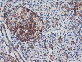PFKP Antibody - IHC of paraffin-embedded Human pancreas tissue using anti-PFKP mouse monoclonal antibody.