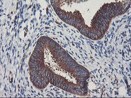 PFKP Antibody - IHC of paraffin-embedded Human endometrium tissue using anti-PFKP mouse monoclonal antibody.