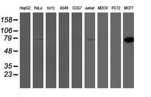 PFKP Antibody - Western blot of extracts (35ug) from 9 different cell lines by using anti-PFKP monoclonal antibody.