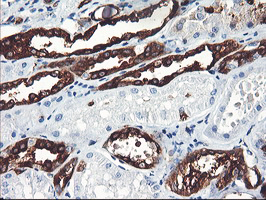 PFKP Antibody - IHC of paraffin-embedded Human Kidney tissue using anti-PFKP mouse monoclonal antibody. (Heat-induced epitope retrieval by 10mM citric buffer, pH6.0, 100C for 10min).