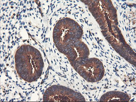 PFKP Antibody - IHC of paraffin-embedded Human endometrium tissue using anti-PFKP mouse monoclonal antibody. (Heat-induced epitope retrieval by 10mM citric buffer, pH6.0, 100C for 10min).