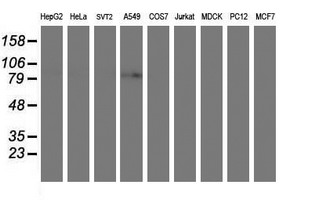 PFKP Antibody - Western blot of extracts (35 ug) from 9 different cell lines by using anti-PFKP monoclonal antibody.