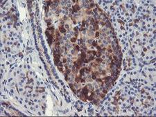 PFKP Antibody - IHC of paraffin-embedded Human pancreas tissue using anti-PFKP mouse monoclonal antibody. (Heat-induced epitope retrieval by 10mM citric buffer, pH6.0, 100C for 10min).