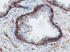 PFKP Antibody - IHC of paraffin-embedded Human prostate tissue using anti-PFKP mouse monoclonal antibody.