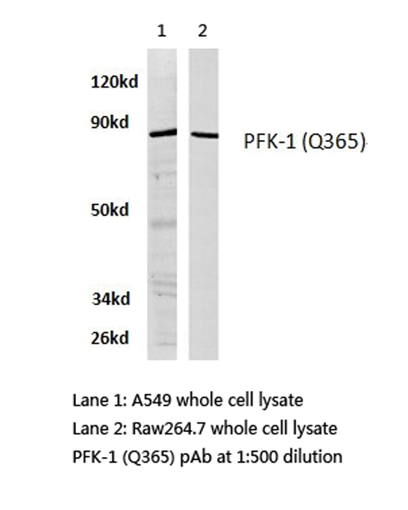 PFKP Antibody - Western blot of PFK-1 (Q365) pAb in extracts from A549 and raw264.7 cell.