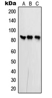 PFKP Antibody - Western blot analysis of PFKP expression in MCF7 (A); NIH3T3 (B); rat brain (C) whole cell lysates.