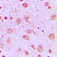 PFKP Antibody - Immunohistochemical analysis of PFKP staining in human brain formalin fixed paraffin embedded tissue section. The section was pre-treated using heat mediated antigen retrieval with sodium citrate buffer (pH 6.0). The section was then incubated with the antibody at room temperature and detected using an HRP conjugated compact polymer system. DAB was used as the chromogen. The section was then counterstained with hematoxylin and mounted with DPX.