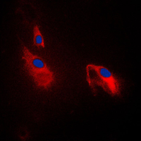 PFKP Antibody - Immunofluorescent analysis of PFKP staining in NIH3T3 cells. Formalin-fixed cells were permeabilized with 0.1% Triton X-100 in TBS for 5-10 minutes and blocked with 3% BSA-PBS for 30 minutes at room temperature. Cells were probed with the primary antibody in 3% BSA-PBS and incubated overnight at 4 C in a humidified chamber. Cells were washed with PBST and incubated with a DyLight 594-conjugated secondary antibody (red) in PBS at room temperature in the dark. DAPI was used to stain the cell nuclei (blue).
