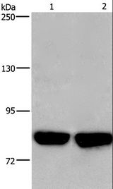 PFKP Antibody - Western blot analysis of HeLa and PC3 cell, using PFKP Polyclonal Antibody at dilution of 1:500.