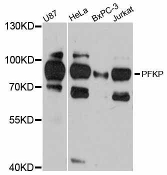 PFKP Antibody - Western blot analysis of extracts of various cell lines, using PFKP antibody at 1:3000 dilution. The secondary antibody used was an HRP Goat Anti-Rabbit IgG (H+L) at 1:10000 dilution. Lysates were loaded 25ug per lane and 3% nonfat dry milk in TBST was used for blocking. An ECL Kit was used for detection and the exposure time was 60s.