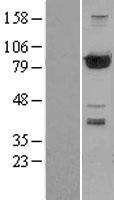 PFKP Protein - Western validation with an anti-DDK antibody * L: Control HEK293 lysate R: Over-expression lysate
