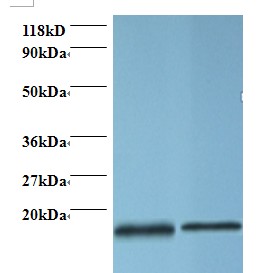 PFN1 / Profilin 1 Antibody - Western blot of Profilin-1 antibody at 2 ug/ml. Lane 1: EC109 whole cell lysate. Lane 2: 293T whole cell lysate. Secondary: Goat polyclonal to Rabbit IgG at 1:15000 dilution. Predicted band size: 15.4 kDa. Observed band size: 15.4 kDa.  This image was taken for the unconjugated form of this product. Other forms have not been tested.