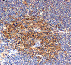 PFN1 / Profilin 1 Antibody - Profilin 1 Antibody - IHC of Profilin in mouse thymus.  This image was taken for the unconjugated form of this product. Other forms have not been tested.
