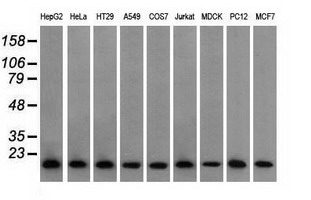 PFN1 / Profilin 1 Antibody - Western blot analysis of extracts (35ug) from 9 different cell lines by using anti-PFN1 monoclonal antibody.
