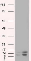 PFN1 / Profilin 1 Antibody - HEK293T cells were transfected with the pCMV6-ENTRY control (Left lane) or pCMV6-ENTRY PFN1 (Right lane) cDNA for 48 hrs and lysed. Equivalent amounts of cell lysates (5 ug per lane) were separated by SDS-PAGE and immunoblotted with anti-PFN1.